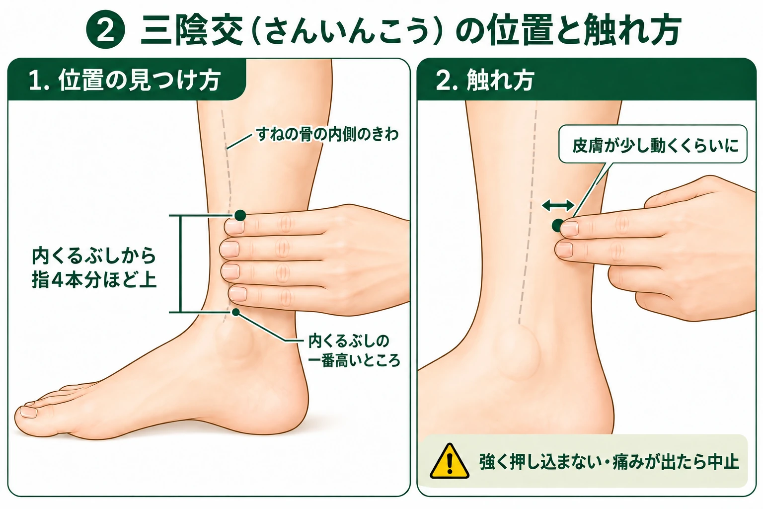 三陰交の位置。内くるぶしから指4本分ほど上、すねの骨の内側のきわを示す図解。